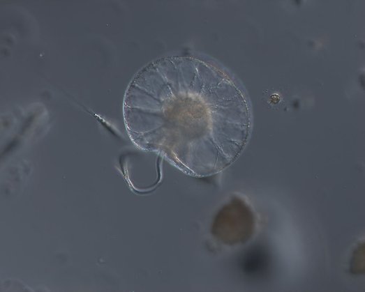En enskild cell av mareld i mikroskop. Foto: Ann-Turi Skjevik, SMHI